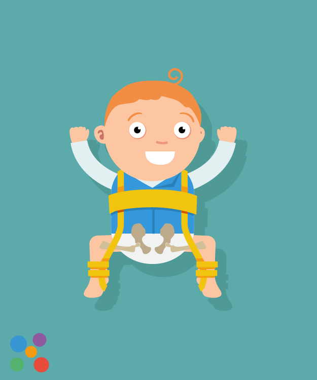Puntales para la displasia de cadera. Gimnasia para la displasia de cadera en niños: terapia de ejercicios. Yeso pa