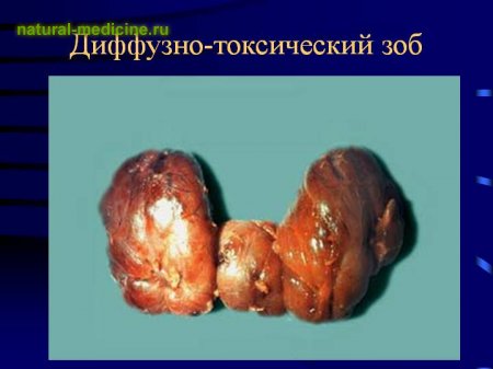 Якщо підскочило артеріальний тиск. Що слід робити якщо підвищився тиск