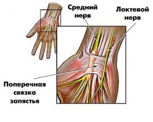 Німіє права долоня і пальці. Якщо німіє мізинець правої руки. Всі пальці правої руки