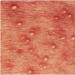 치골에 매달려 비난하는 이유